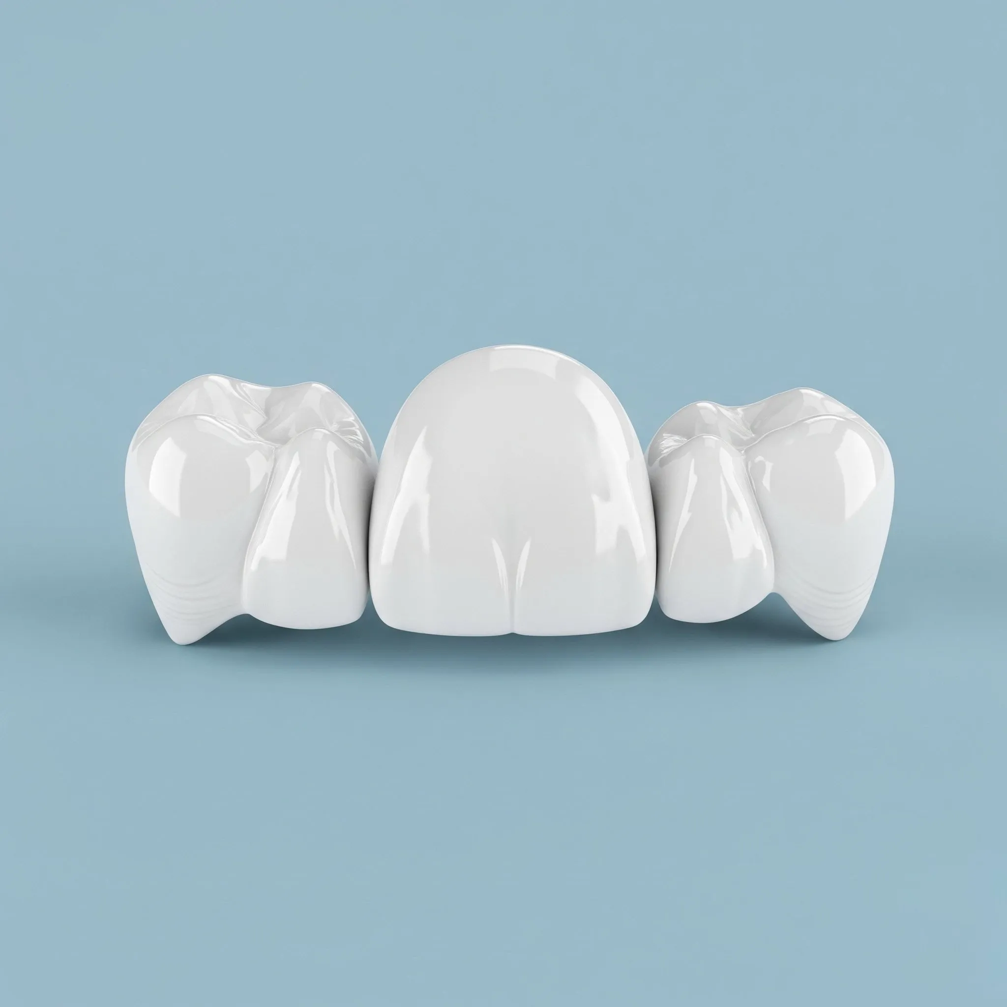 Dental Bridges